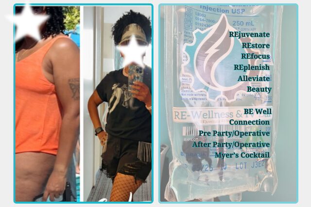 Look and Feel Good Before and after photo of weight management client next to the a list of IV treatments.