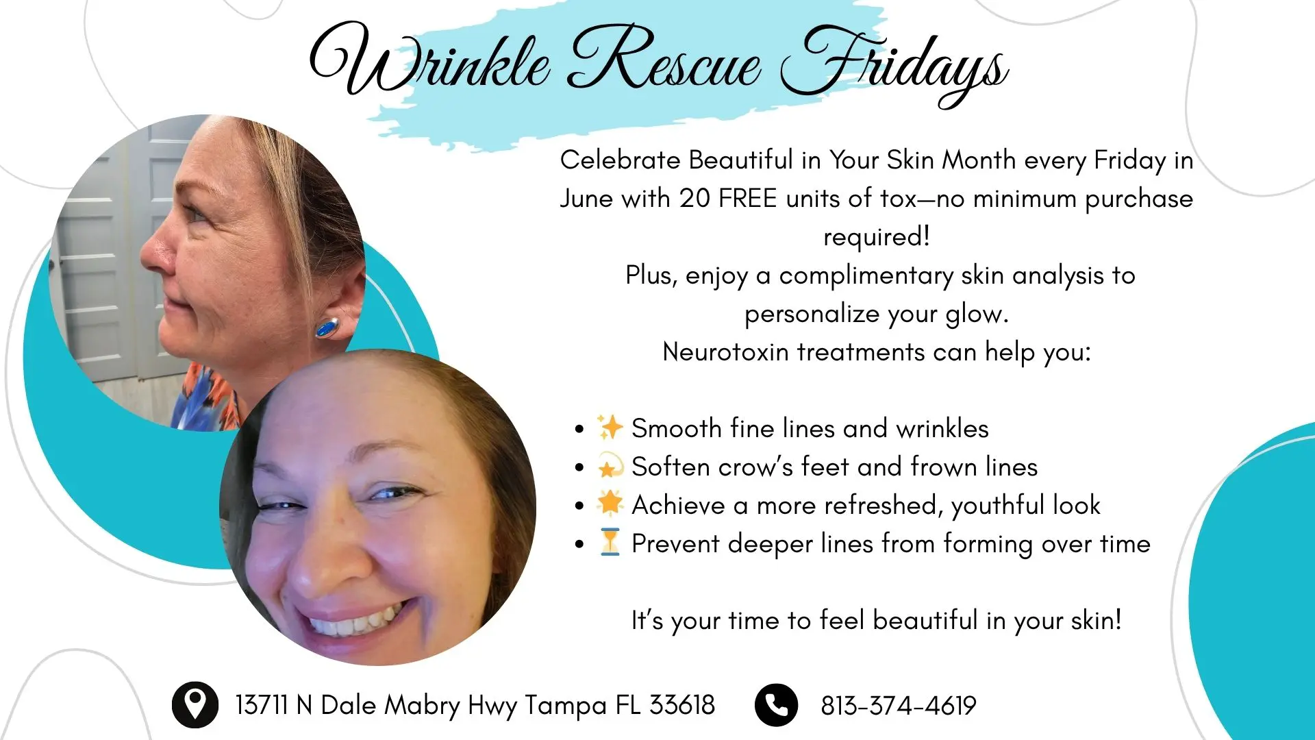 Wrinkle Rescue Fridays List of benefits of neurotoxin with before and after photo.